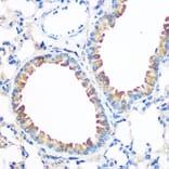 Immunohistochemistry - Anti-AGR2 Antibody (A10053) - Antibodies.com