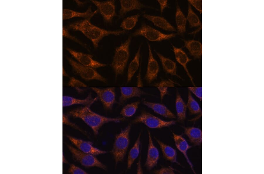 Immunofluorescence - Anti-AGR2 Antibody (A10053) - Antibodies.com