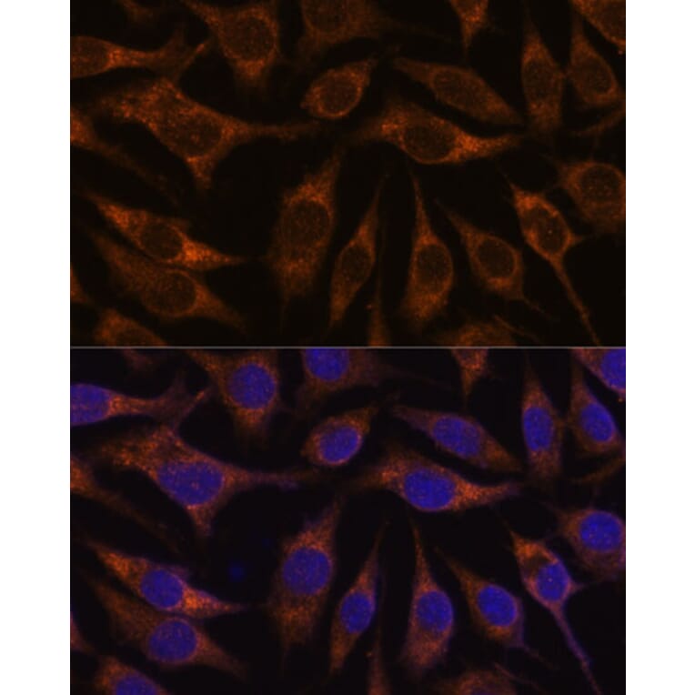 Immunofluorescence - Anti-AGR2 Antibody (A10053) - Antibodies.com