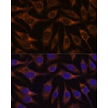 Immunofluorescence - Anti-AGR2 Antibody (A10053) - Antibodies.com