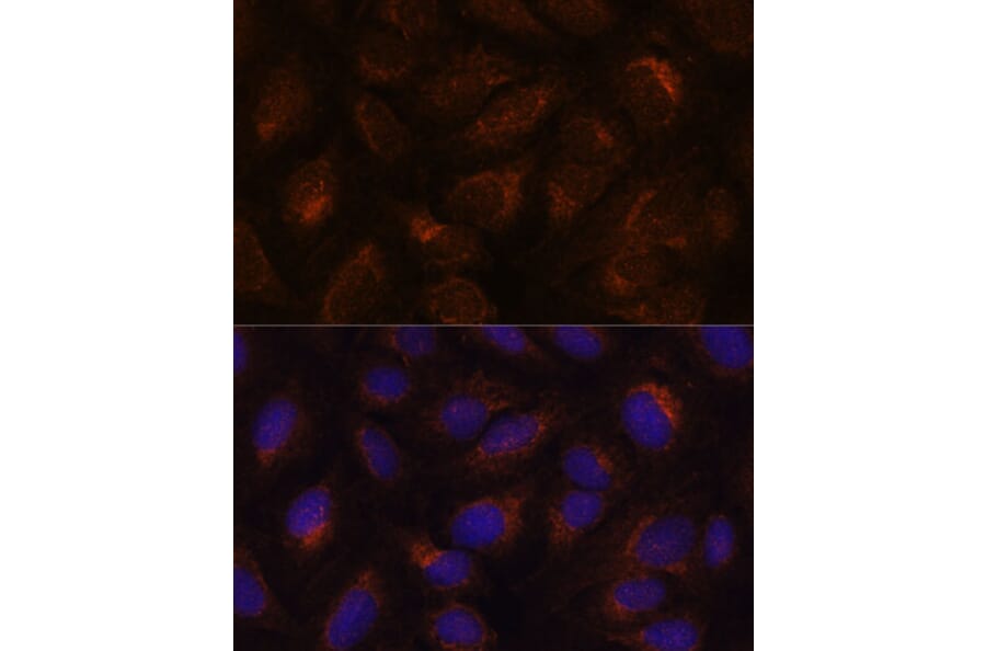 Immunofluorescence - Anti-AGR2 Antibody (A10053) - Antibodies.com