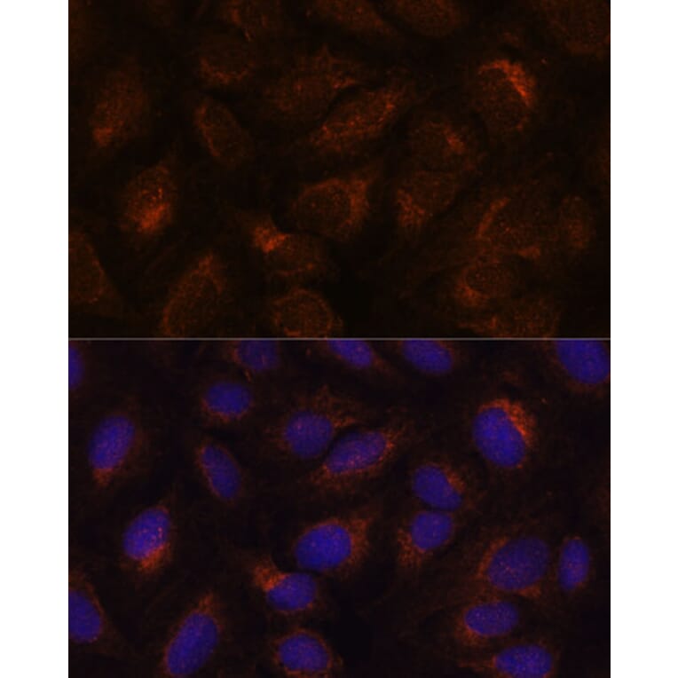 Immunofluorescence - Anti-AGR2 Antibody (A10053) - Antibodies.com