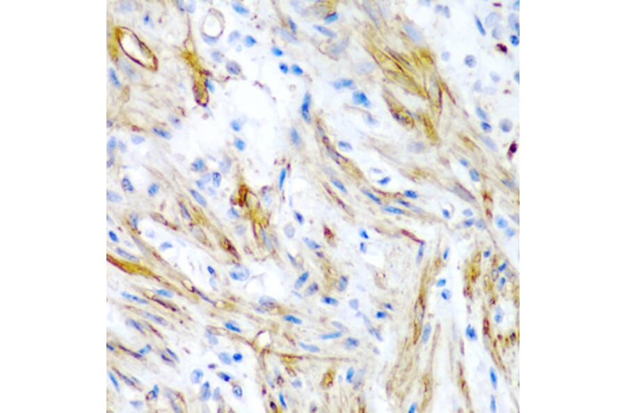 Immunohistochemistry - Anti-LMOD1 Antibody (A10054) - Antibodies.com