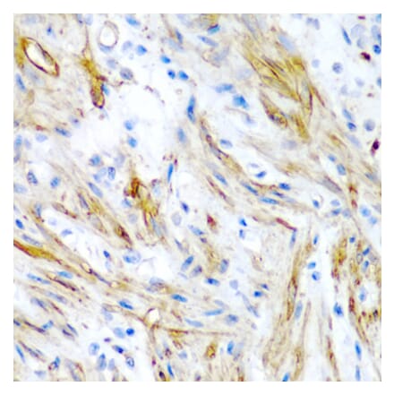 Immunohistochemistry - Anti-LMOD1 Antibody (A10054) - Antibodies.com