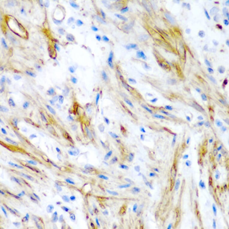 Immunohistochemistry - Anti-LMOD1 Antibody (A10054) - Antibodies.com