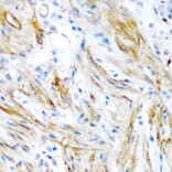 Immunohistochemistry - Anti-LMOD1 Antibody (A10054) - Antibodies.com