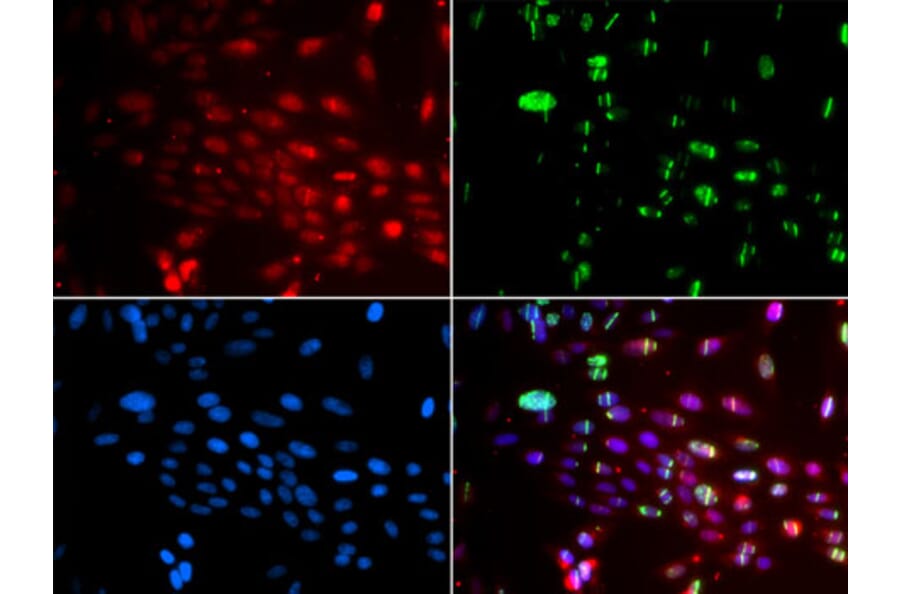 Immunofluorescence - Anti-L3MBTL1 Antibody (A10056) - Antibodies.com