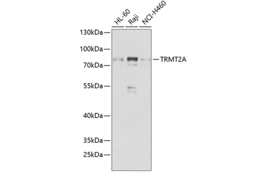 Western Blot - Anti-TRMT2A Antibody (A7095) - Antibodies.com