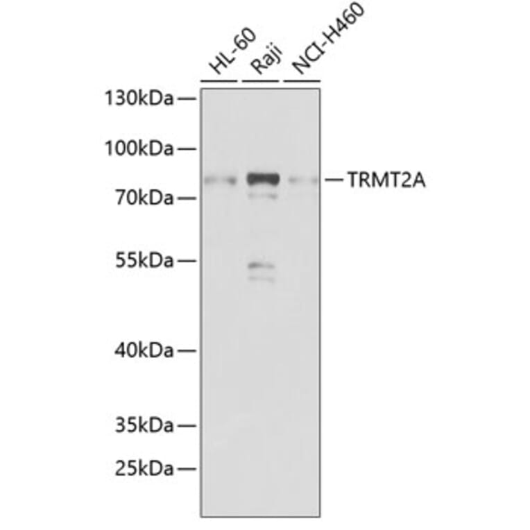 Western Blot - Anti-TRMT2A Antibody (A7095) - Antibodies.com