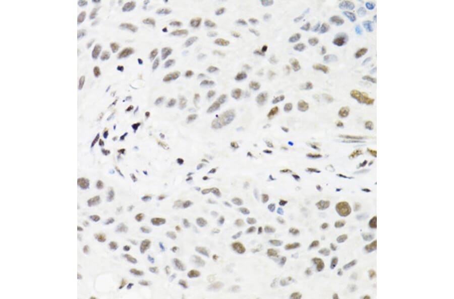 Immunohistochemistry - Anti-TRMT2A Antibody (A7095) - Antibodies.com