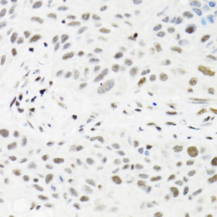 Immunohistochemistry - Anti-TRMT2A Antibody (A7095) - Antibodies.com