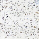 Immunohistochemistry - Anti-TRMT2A Antibody (A7095) - Antibodies.com