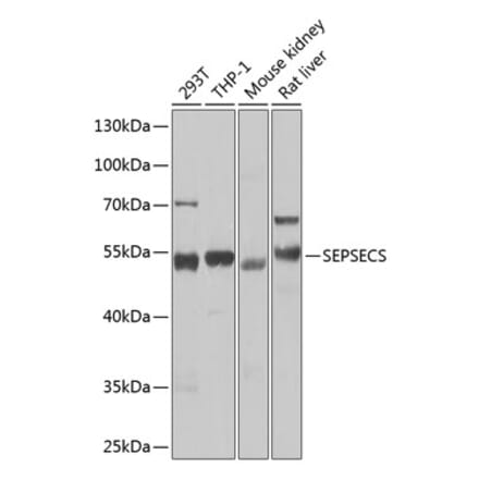 Western Blot - Anti-SEPSECS Antibody (A10058) - Antibodies.com