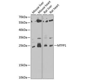 Western Blot - Anti-MTP18 Antibody (A10059) - Antibodies.com