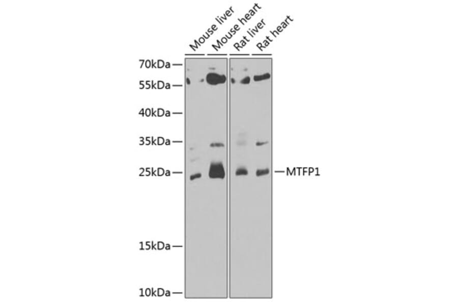 Western Blot - Anti-MTP18 Antibody (A10059) - Antibodies.com