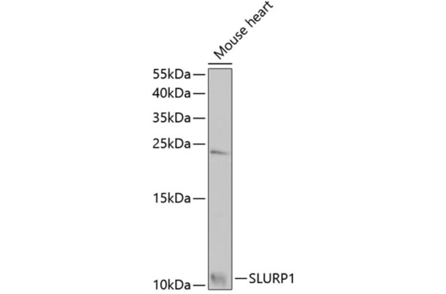 Western Blot - Anti-SLURP1 Antibody (A7123) - Antibodies.com