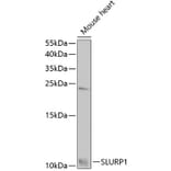 Western Blot - Anti-SLURP1 Antibody (A7123) - Antibodies.com