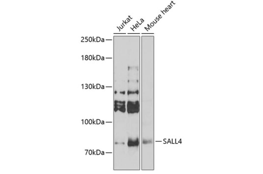 Western Blot - Anti-Sall4 Antibody (A10062) - Antibodies.com