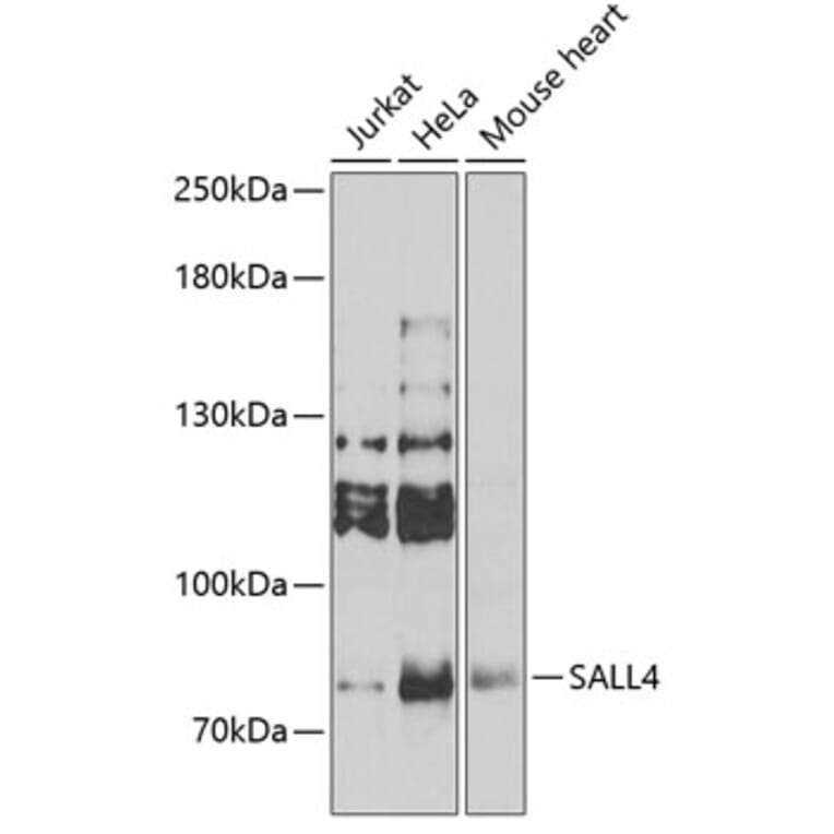 Western Blot - Anti-Sall4 Antibody (A10062) - Antibodies.com