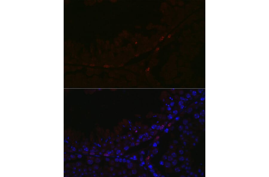 Immunofluorescence - Anti-Sall4 Antibody (A10062) - Antibodies.com