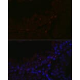 Immunofluorescence - Anti-Sall4 Antibody (A10062) - Antibodies.com