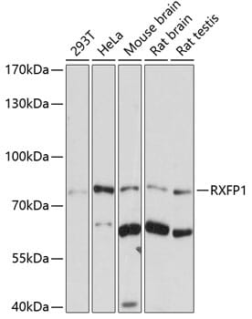 Western blot analysis of extracts of various cell lines, using Anti-RXFP1 Antibody (A7127) at 1:1,000 dilution.
Secondary antibody: Goat Anti-Rabbit IgG (H+L) (HRP) (AS014) at 1:10,000 dilution.
Lysates / proteins: 25µg per lane.
Blocking buffer: 3% non-fat dry milk in TBST.
Detection: ECL Basic Kit (RM00020).
Exposure time: 30s.