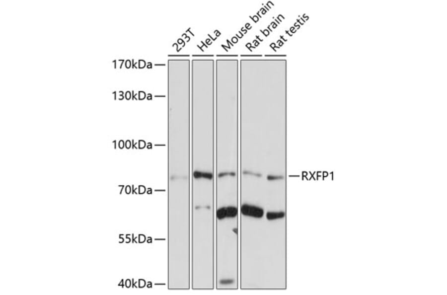 Western Blot - Anti-RXFP1 Antibody (A10063) - Antibodies.com