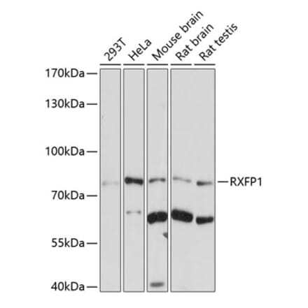 Western Blot - Anti-RXFP1 Antibody (A10063) - Antibodies.com