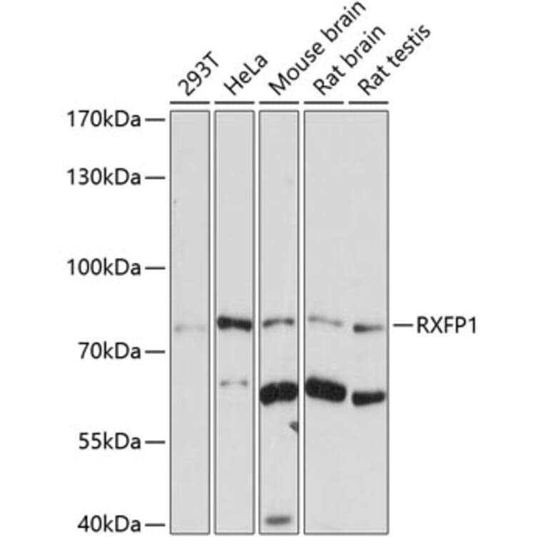 Western Blot - Anti-RXFP1 Antibody (A10063) - Antibodies.com