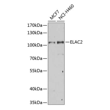 Western Blot - Anti-ELAC2 Antibody (A10064) - Antibodies.com