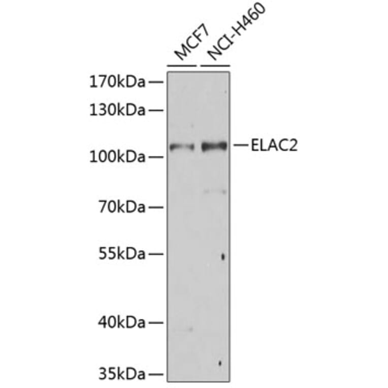 Western Blot - Anti-ELAC2 Antibody (A10064) - Antibodies.com