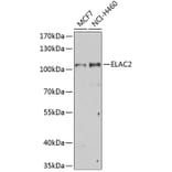 Western Blot - Anti-ELAC2 Antibody (A10064) - Antibodies.com