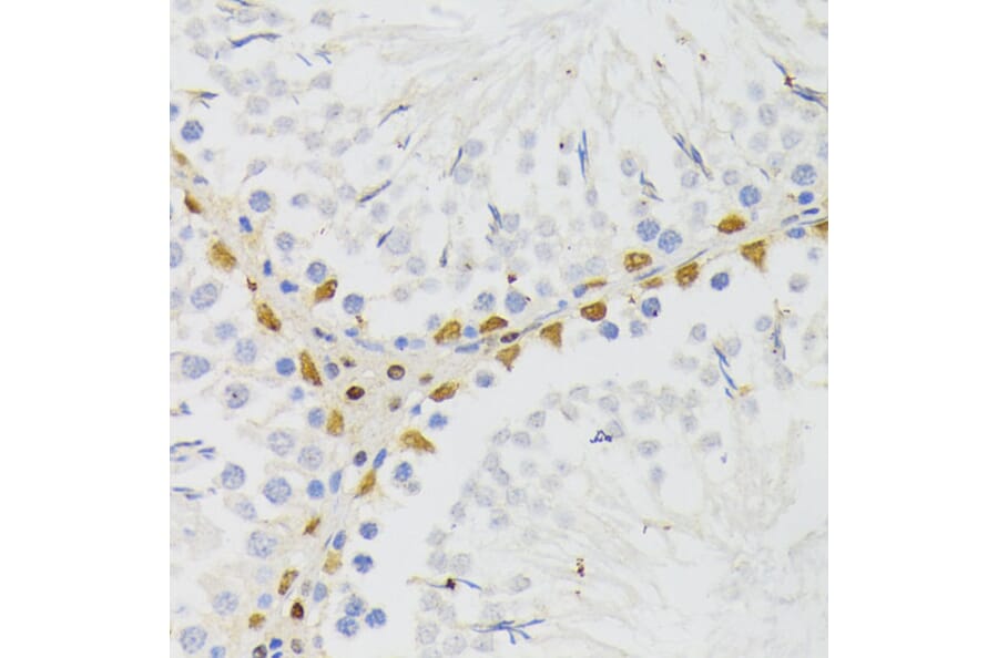 Immunohistochemistry - Anti-ELAC2 Antibody (A10064) - Antibodies.com