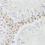 Immunohistochemistry - Anti-ELAC2 Antibody (A10064) - Antibodies.com