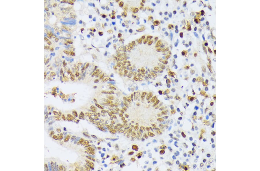 Immunohistochemistry - Anti-ELAC2 Antibody (A10064) - Antibodies.com
