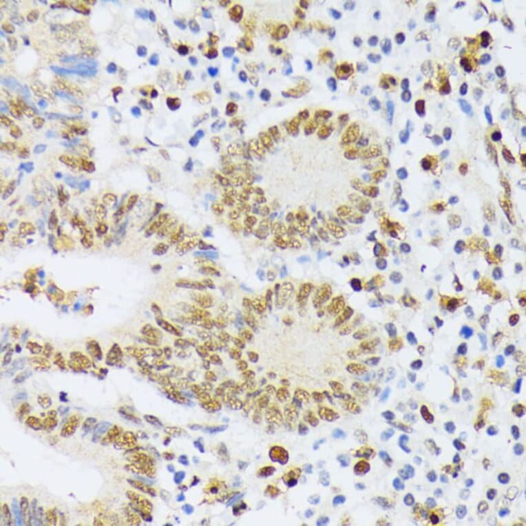 Immunohistochemistry - Anti-ELAC2 Antibody (A10064) - Antibodies.com