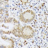 Immunohistochemistry - Anti-ELAC2 Antibody (A10064) - Antibodies.com