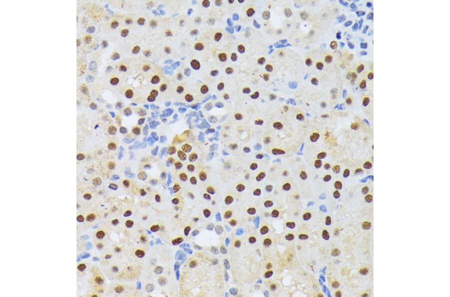Immunohistochemistry - Anti-ELAC2 Antibody (A10064) - Antibodies.com