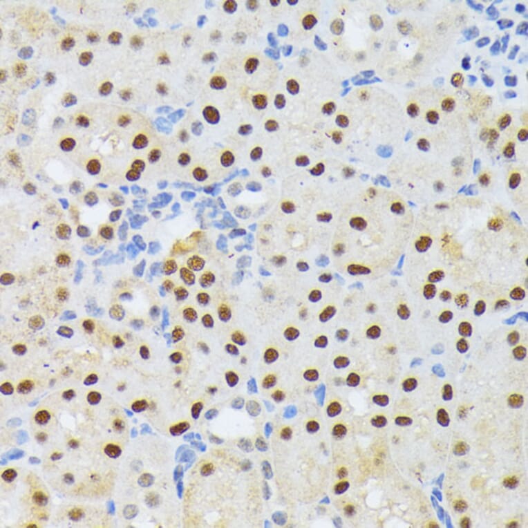 Immunohistochemistry - Anti-ELAC2 Antibody (A10064) - Antibodies.com