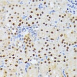 Immunohistochemistry - Anti-ELAC2 Antibody (A10064) - Antibodies.com