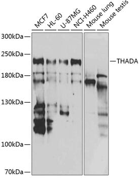 Western blot analysis of extracts of various cell lines, using Anti-THADA Antibody (A7129) at 1:1,000 dilution.
Secondary antibody: Goat Anti-Rabbit IgG (H+L) (HRP) (AS014) at 1:10,000 dilution.
Lysates / proteins: 25µg per lane.
Blocking buffer: 3% non-fat dry milk in TBST.
Detection: ECL Basic Kit (RM00020).
Exposure time: 90s.