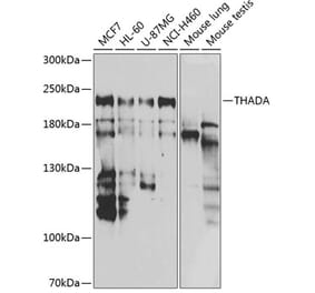 Western Blot - Anti-THADA Antibody (A10065) - Antibodies.com