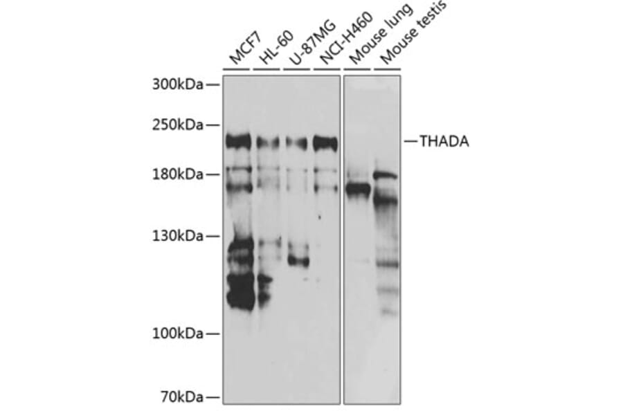 Western Blot - Anti-THADA Antibody (A10065) - Antibodies.com