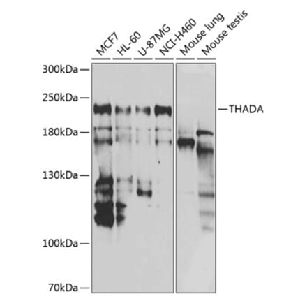 Western Blot - Anti-THADA Antibody (A10065) - Antibodies.com