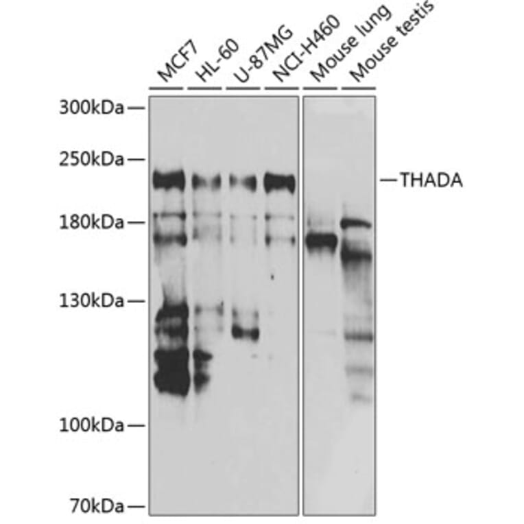 Western Blot - Anti-THADA Antibody (A10065) - Antibodies.com