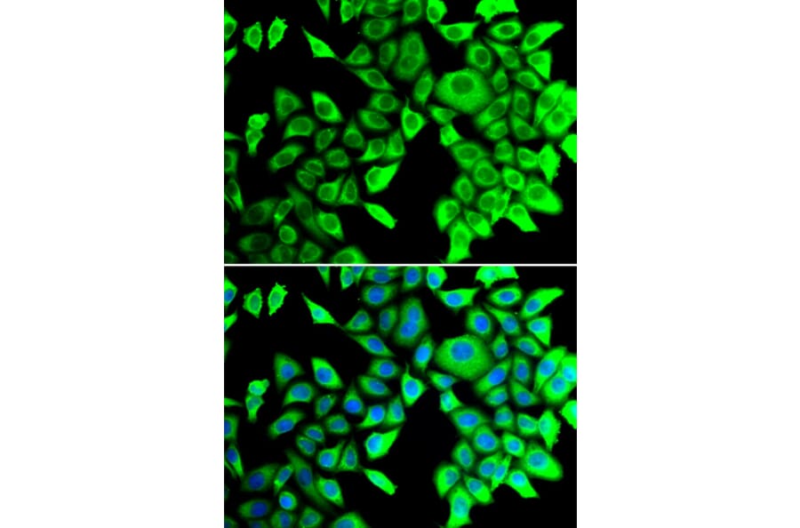 Immunofluorescence - Anti-THADA Antibody (A10065) - Antibodies.com
