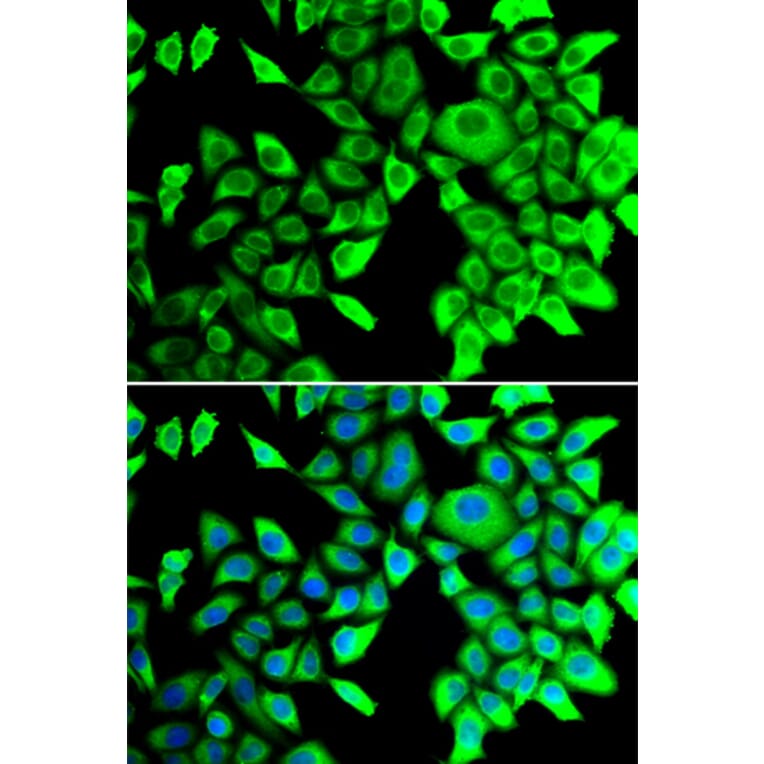 Immunofluorescence - Anti-THADA Antibody (A10065) - Antibodies.com