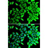 Immunofluorescence - Anti-THADA Antibody (A10065) - Antibodies.com