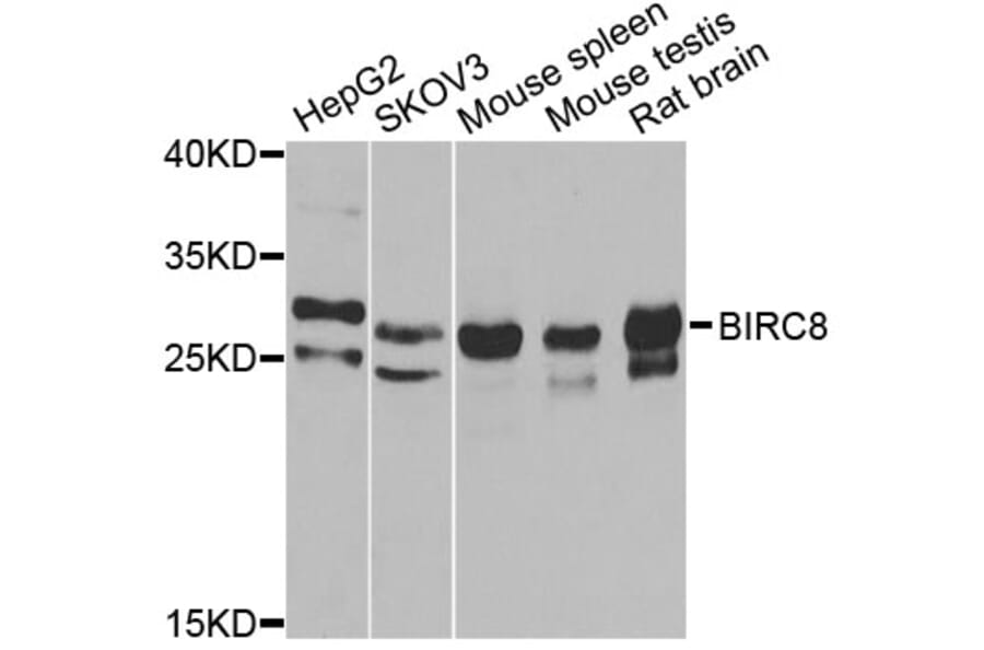 Western Blot - Anti-BIRC8 Antibody (A7143) - Antibodies.com