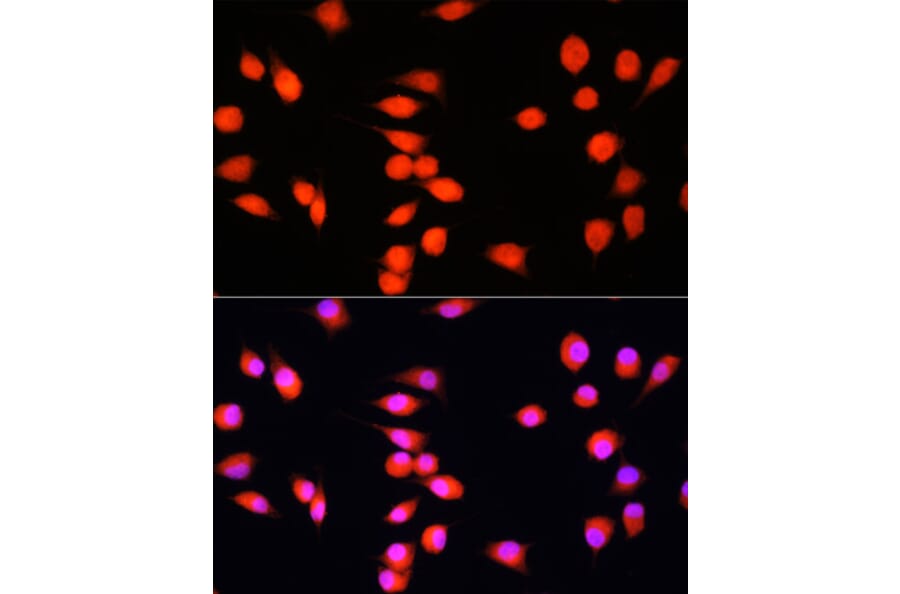 Immunofluorescence - Anti-COMMD1/MURR1 Antibody (A10068) - Antibodies.com